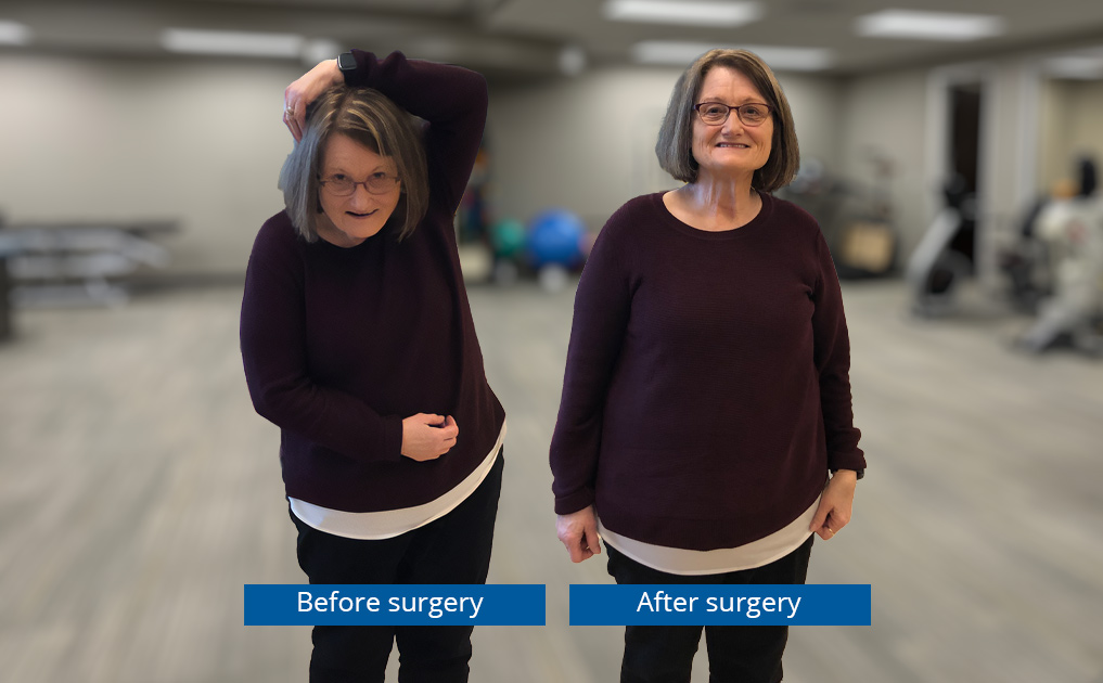 photo: Dora before and after surgery