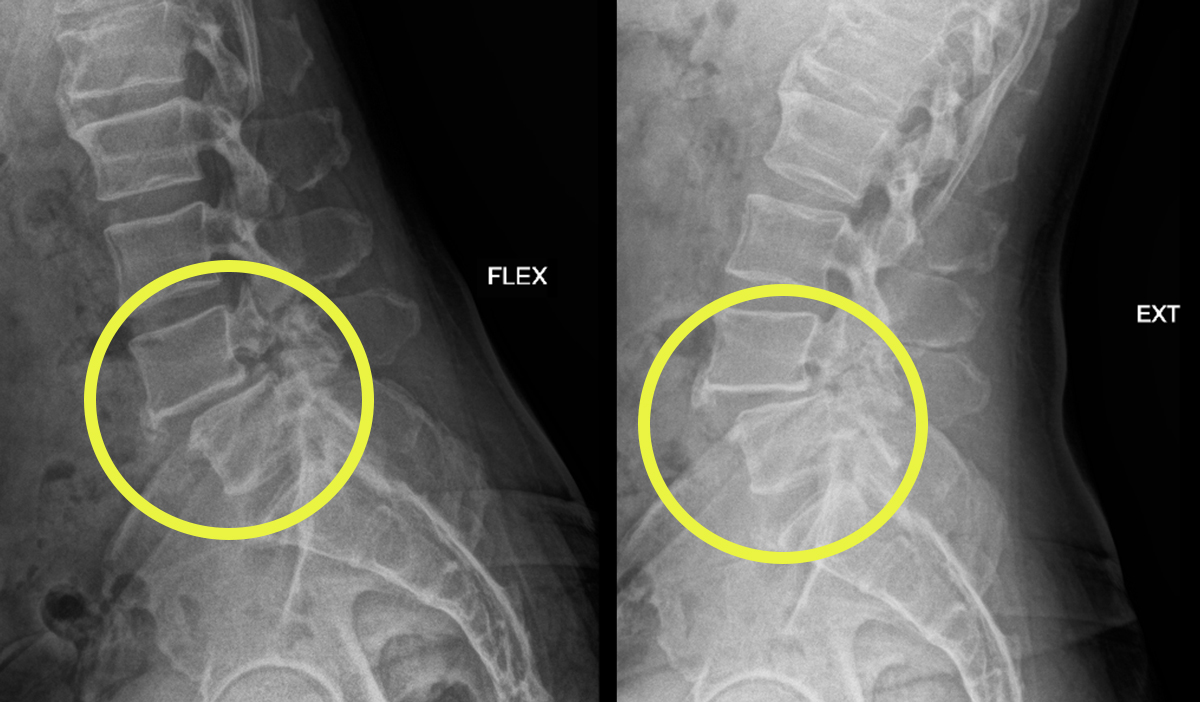 Photo of Jeff's imaging