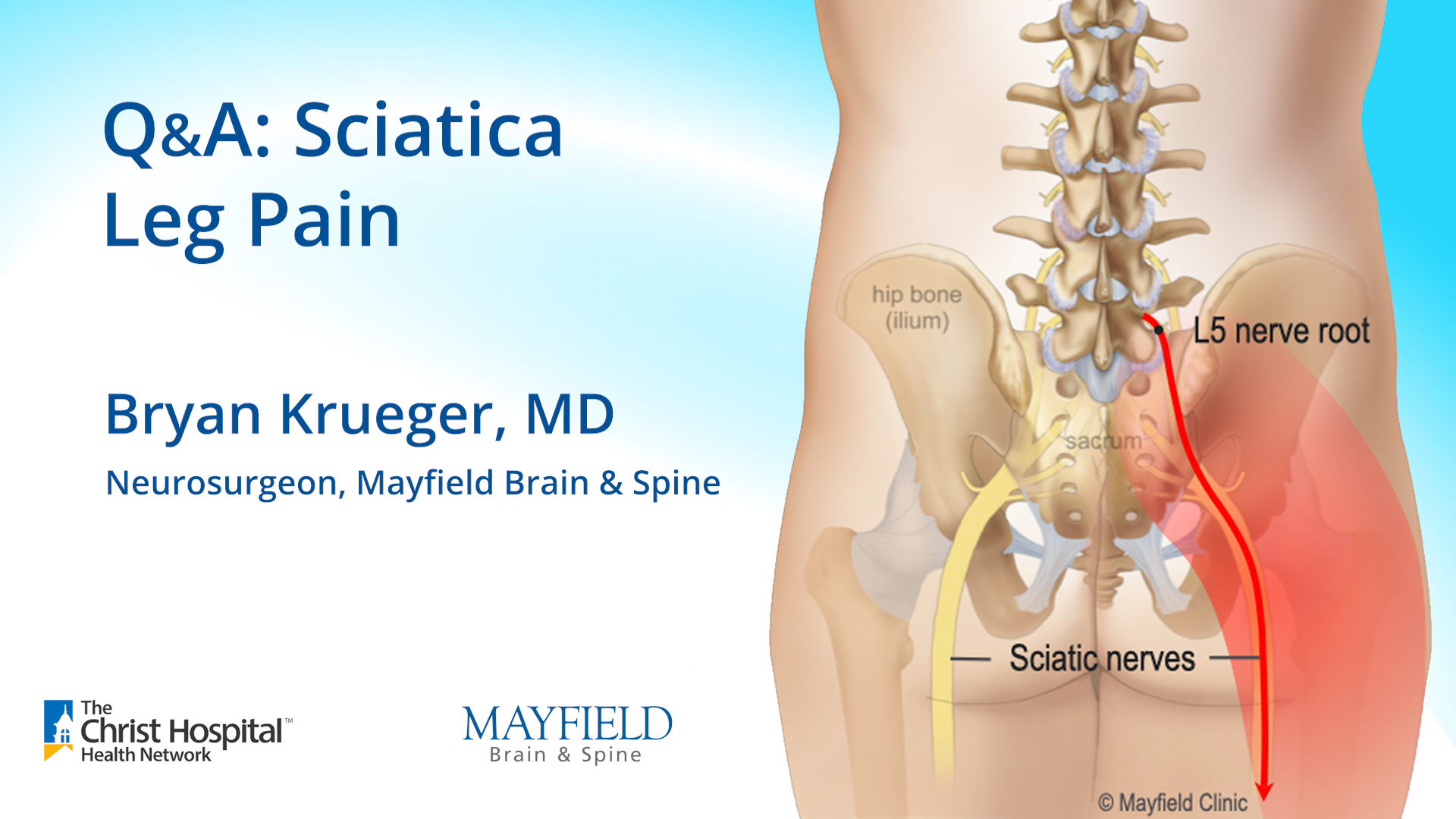 q-a-sciatica-leg-pain-w-dr-bryan-krueger