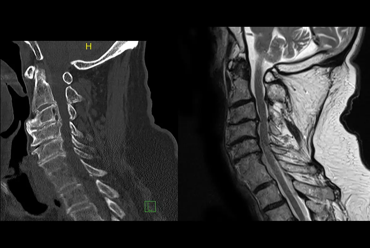 Len's imaging pre-op