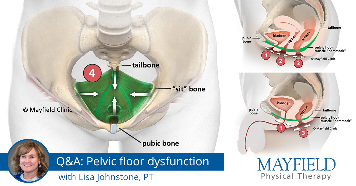 Pelvic Floor Dysfunction